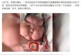 冲上热搜！婴儿使用抑菌霜后成"大头娃娃"？这些事你一定要知道图片