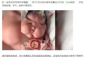 冲上热搜！婴儿使用抑菌霜后成"大头娃娃"？这些事你一定要知道图片