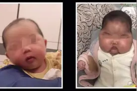 扬州也有宝宝中招！11月大男婴用了这款面霜后头部肿大图片