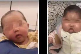 长期不当使用激素药膏或致满月脸，专家提供湿疹宝宝避坑指南图片