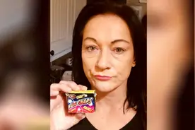 英国女子误食爆竹 致口腔烧伤牙齿裂开图片
