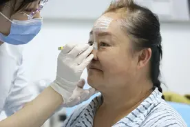 43年后，新氧公益帮我找回了鼻子图片