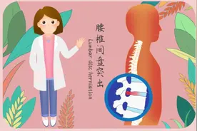 哪些人群容易得腰椎间盘突出症？图片