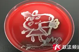 脑洞大开！用细菌作画你见过吗？长沙90后医生做到了图片