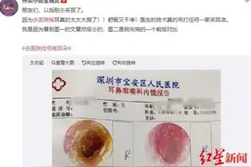 “去医院挂号掏耳朵”上热搜，医生这样说，网友体验后直呼：太爽了图片
