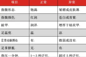 养生先看脚！长不长寿，看看双脚就知道图片