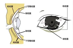 眼睛红了就是得了结膜炎吗？图片