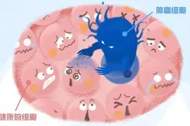 早期治愈率可达60%以上！乳腺癌筛查和检查这样做图片