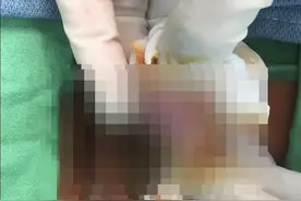 那边没洗「陈年黄石垢」臭炸！医曝包皮垢藏2功能　这样清才干净图片