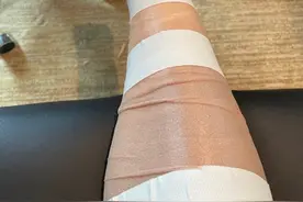 CBA | 赵继伟脚伤未伤及骨 治疗时间需要三至四周图片