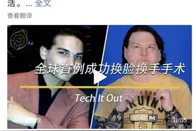 美国成功完成首例换脸换手联合移植手术！其实“换脸”早已成真，但伦理困境仍在图片