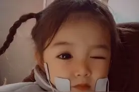 心疼！4岁女孩拥有天使面孔，却患上这种可怕疾病...图片