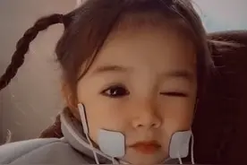 心疼！4岁女孩拥有天使面孔，却患上这种可怕疾病...图片
