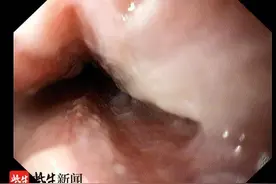 保温杯装开水“惹祸”，八龄童喝水烫伤食管图片