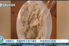 河南：男童吃饺子吞下“幸运币”，腹痛一年未发现，取出时已腐蚀视频封面