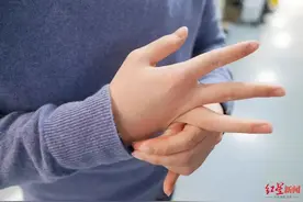 手指可任意折叠，天生骨骼清奇？医生：这是病图片