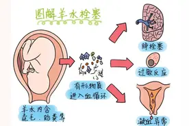 徐医附院麻醉科 | 一例羊水栓塞术前、术中的麻醉方案图片