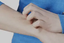 别大意！孩子身上出红疹，原因可能不简单图片