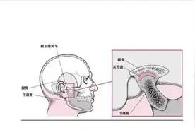 福州一女子张嘴“咔哒”响，医生：这是一种病，叫TMD图片