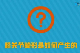 「健康解码」膝关节畸形要警惕 不仅是难看图片