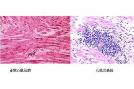 华米科技：成就健康使命 智能可穿戴产品力“破圈”图片