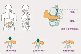 小撞击可能有大隐患 被方向盘撞到腹部后应警惕胰腺内伤图片