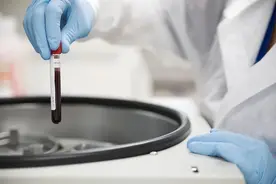 电视剧中的“滴血认亲”有科学依据吗？终于知道真相了……图片