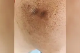 陕西一员工年会被高管烟头烫脸：疼才长记性，网友炸了图片