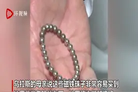 土耳其小男孩吞19枚强力磁铁 将肠道黏一起引腹痛图片