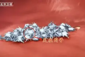 抬头纹越多，心脑血管疾病风险越高！这些症状可能提示血管受损，赶紧自查图片