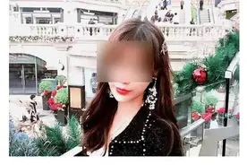 女孩整容致智力下降至1岁，都是审美焦虑惹的祸图片