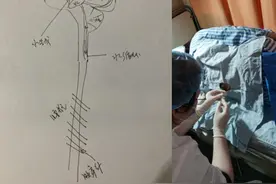 年轻女孩六天三顾急诊，妈妈却拒绝“腰穿”，医生画图让她们安心图片