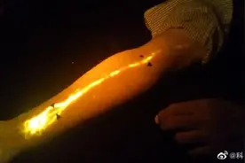科研人员首次清晰观察到沿人体经络穴位迁移的连续荧光线图片