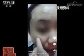 美容变毁容：荧光脸、激素脸频现……皮肤科专家：一定要远离这些“陷阱”图片