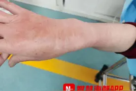 最担心的事情还是发生了！女子被咬后休克图片
