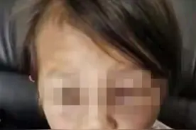 云南一女童遭怀孕继母虐打，当地妇联：已上门看望并心理辅导图片