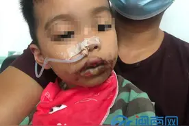 泉州一5岁男童误食管道疏通剂满嘴流血，被送医院救治图片