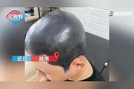 越南男子剃光头后怕被妻子发现，竟把头皮纹成黑色！结果悲剧了图片