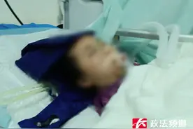 美容需谨慎！21岁女孩整形期间昏迷，抢救14天仍未醒来图片