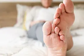 怎么判断是不是得了足癣（脚气）？视频封面