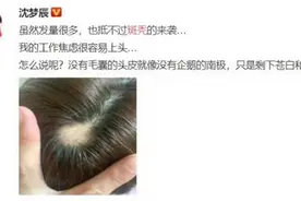 女明星斑秃上热搜！传说中的“鬼剃头”盯上年轻人，很多人还蒙在鼓里图片