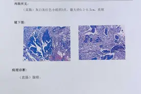 爸爸确诊肠癌，我从死神手里抢他的命图片