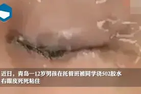 青岛12岁男孩被托管班同学浇502胶水，右眼皮死死粘住！网友怒了图片