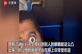 美国一喜剧演员骨骼清奇 随时能把眼球挤出眼窝图片