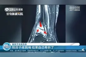 妈妈陪孩子练跳绳后，小腿疼了两个多星期，到医院一查“傻眼”了……图片