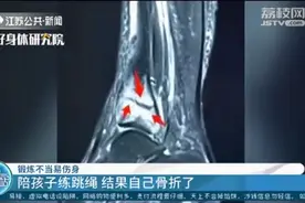 妈妈陪孩子练跳绳后，小腿疼了两个多星期，到医院一查“傻眼”了图片