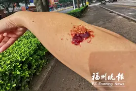 行道树上结的“葡萄”能吃吗？园林专家：不建议食用图片