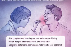 灼口综合征图片