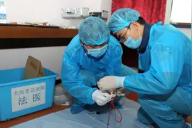 站在解剖台前，法医哽咽了：谁会下此毒手？图片