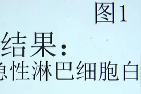 湖南14岁少年身高1米8全身突发疼痛确诊白血病！孩子身体这些异常要当心图片